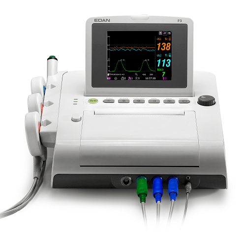 Fetalmonitoring CTG