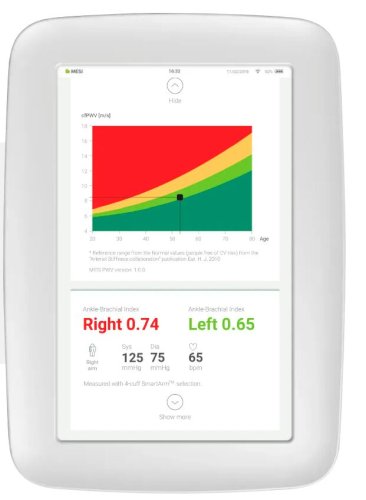 MESI PWV APP Pulswellengeschwindigkeit 